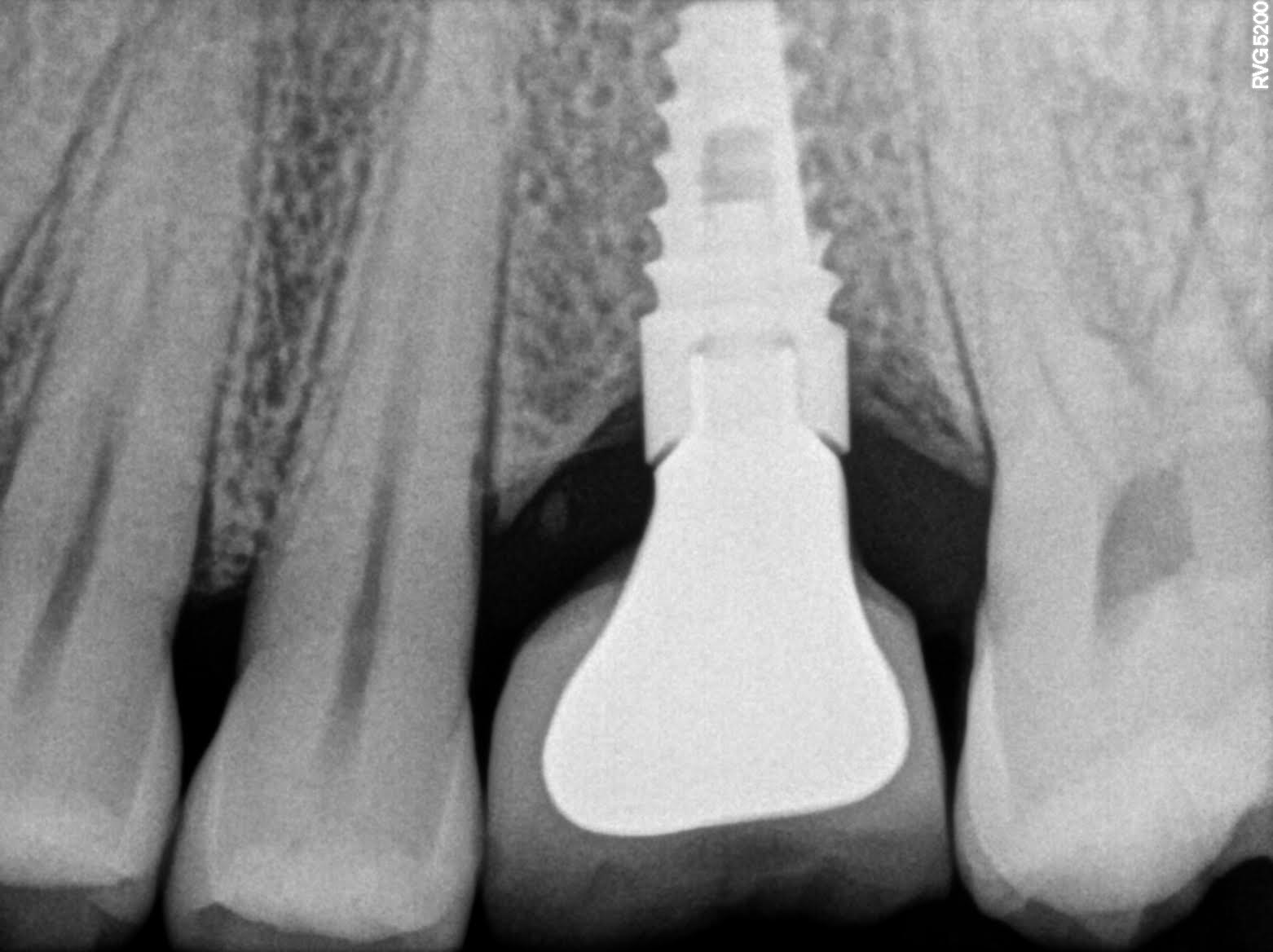 Dental X-ray